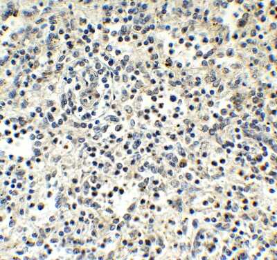 Immunohistochemistry-Paraffin: MNDA Antibody - BSA Free [NBP3-18134]